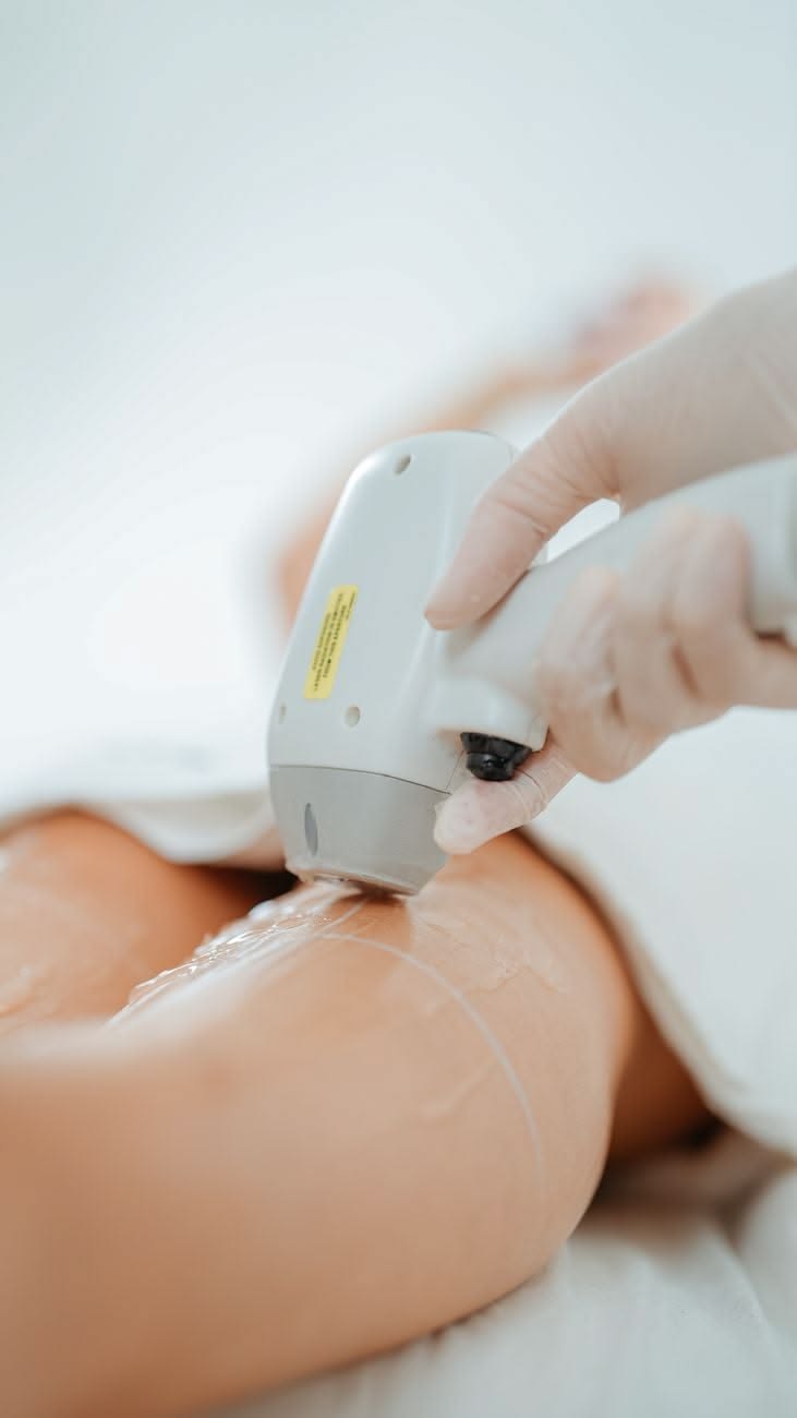 Laserhårfjerning på bein utført hos Clinic Yvonne